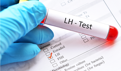 LH 黄体生成素检测